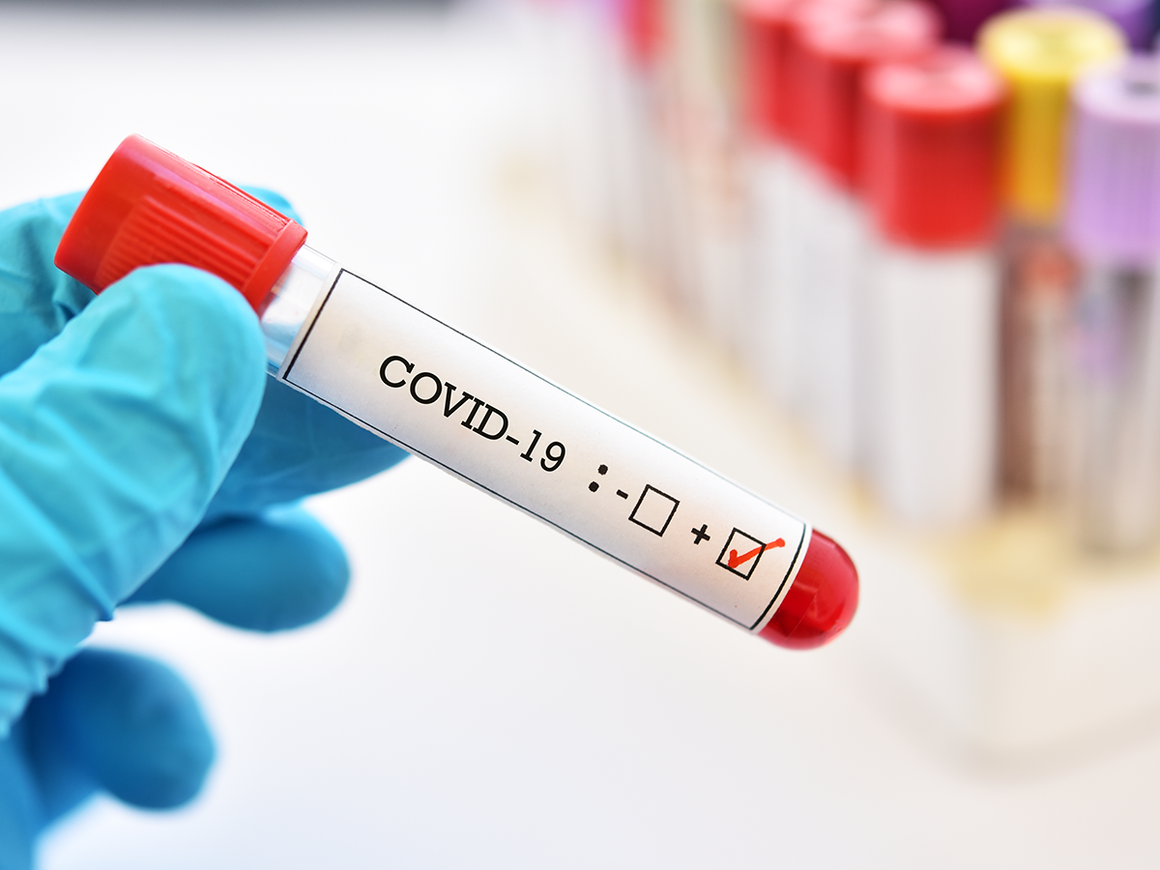 https://www.comune.gubbio.pg.it/news/54549-Ccoronavirus-test.png